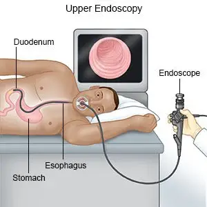 Upper Endoscopy