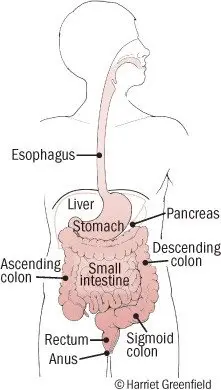 Peptic Ulcer