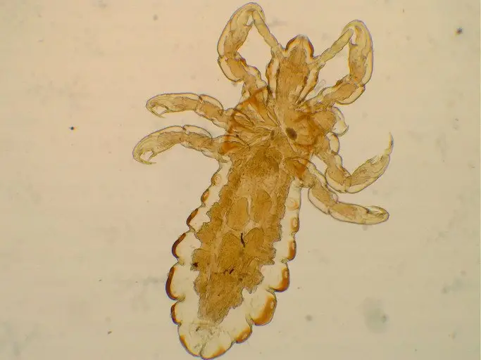 Head Lice