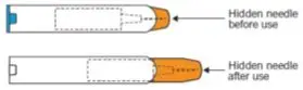 Figure G. Never-See-Needle