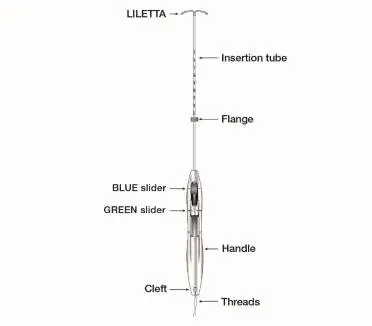 Figure 1b