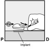 Figure 8b