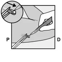 Figure 14