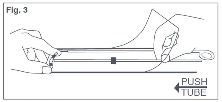 Figure 3: Bending T-Arms of Paraguard While in Sterile Packaging 