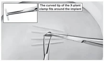 Figure 16