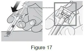 image of plunger push - instructions for use