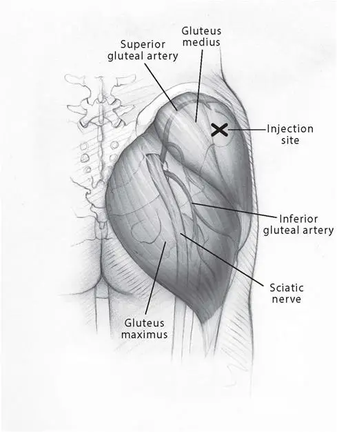 Figure1