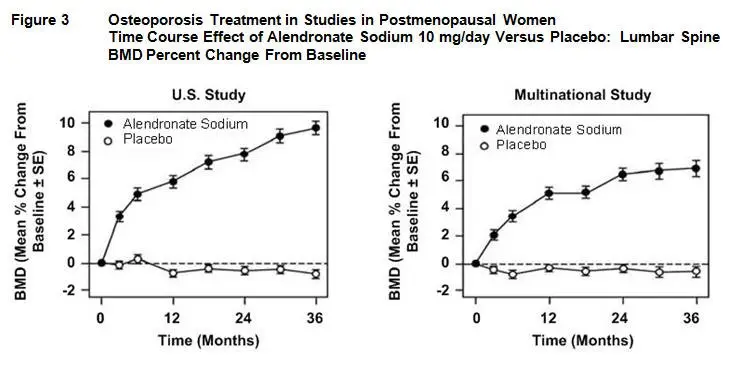 Figure 3 Osteoporosis