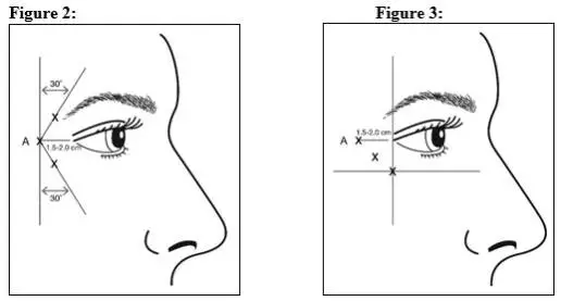 Figure 2 and 3