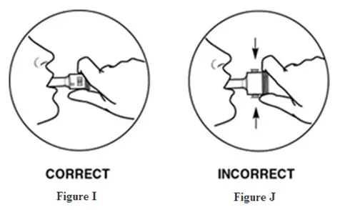 Tilt your head back slightly. Keep the AEROLIZER Inhaler level, with the blue buttons to the left and right (not up and down).  Place the mouthpiece in your mouth and close your lips around the mouthpiece. (Figures I and J)