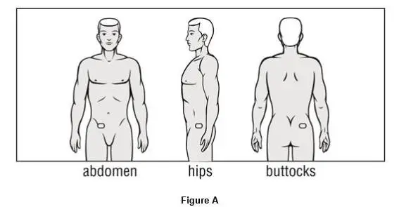 ·	Do not use the same area for the patch for at least 1 week. You may choose to try different sites when using OXYTROL to find the sites that are most comfortable for you and where clothing will not rub against it. 