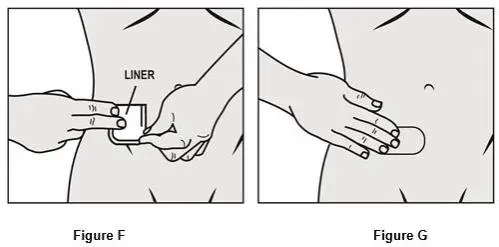 ·	Bend the patch in half and gently roll the remaining part onto your skin using the tips of your fingers. As you roll the patch in place, the second piece of the protective liner should come off the patch. See Figure F.
·	Apply firm pressure over the surface of the patch with your fingers to make sure the patch stays on. See Figure G.
