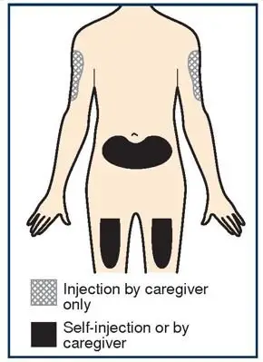 step_4_injection_site