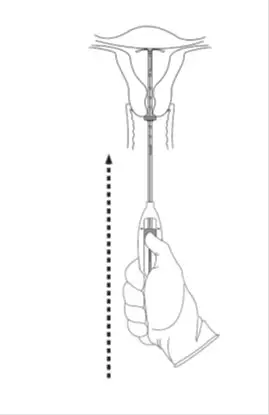 Fundal Position