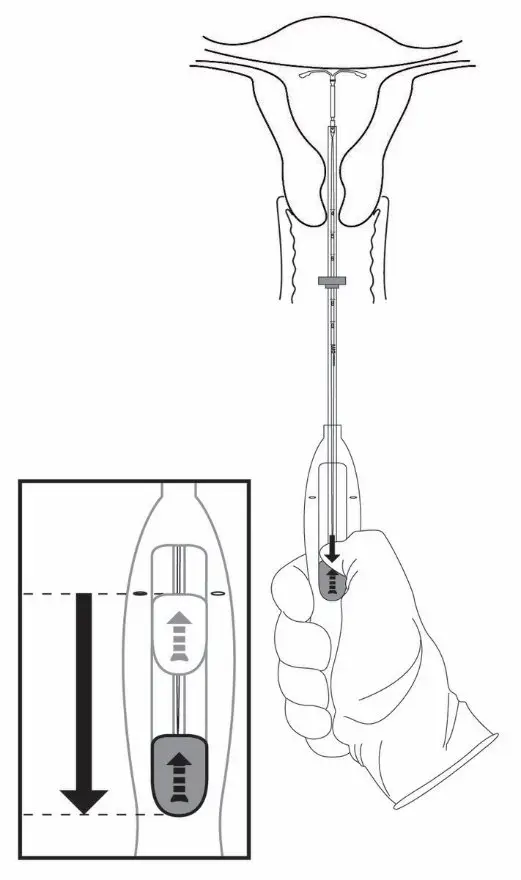 Illustration of pen cap.