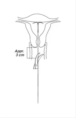 Cutting Threads