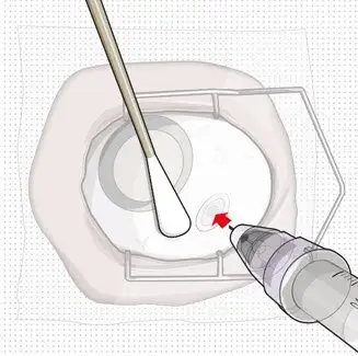 Figure 25