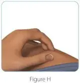 Figure H
