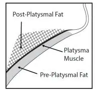 Figure 2. Sagittal View of Platysma Area