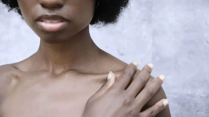 close up of a Black person's skin