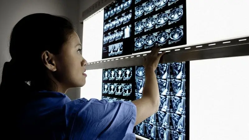 A technician looks at a wall of images of brain scans