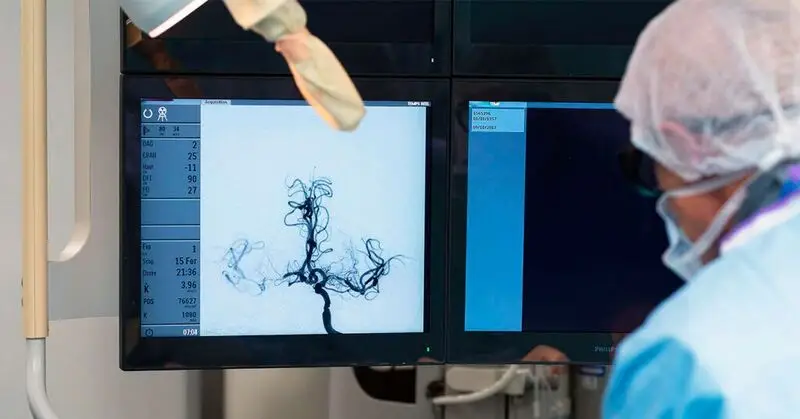 Technicians review a brain scan of a stroke patient