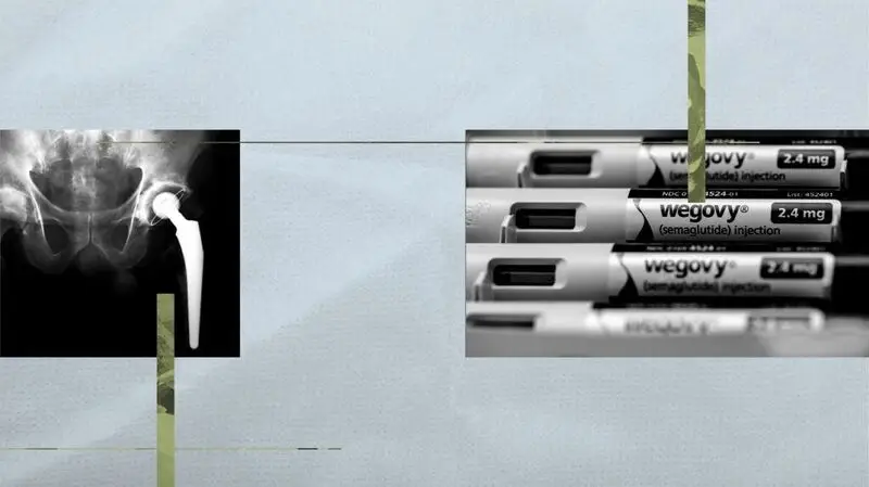 An illustration of a hip bone X-ray and 4 injections of semaglutide belonging to the Wegovy brand