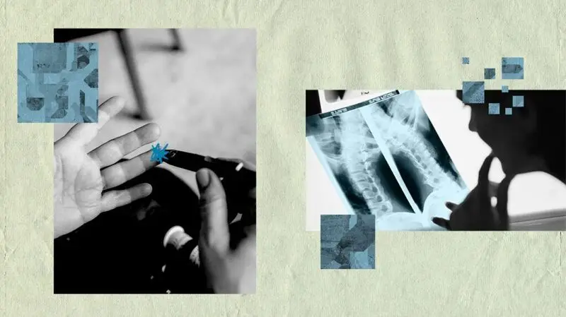A collage and illustration of a person measuring their blood sugar via finger prick test and an X-ray of the spine, side by side