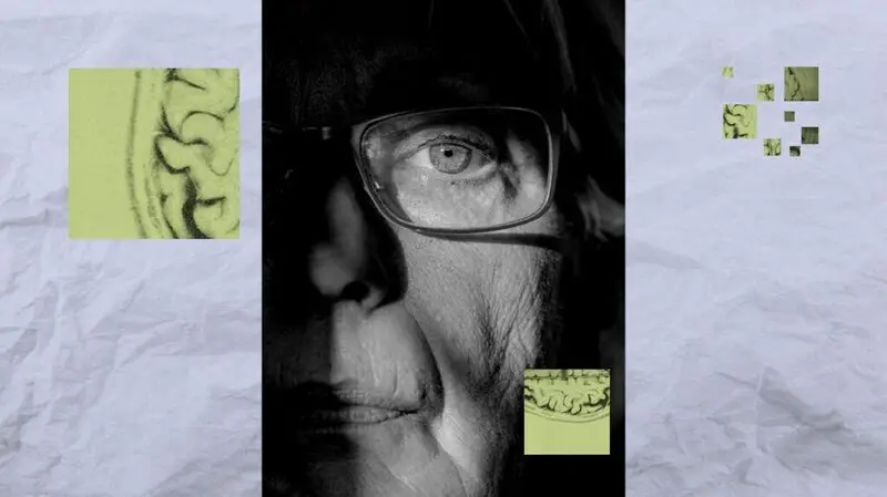 collage showing black and white close-up of older woman's face and illustrations of brain matter