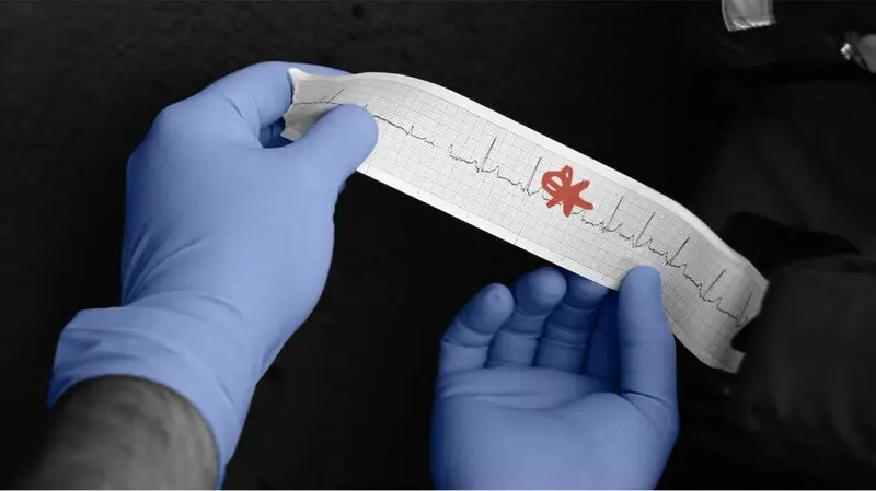 gloved hands holding an electrocardiogram printout strip