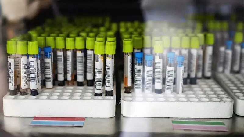 Close-up view of laboratory blood sample test tubes for colorectal cancer