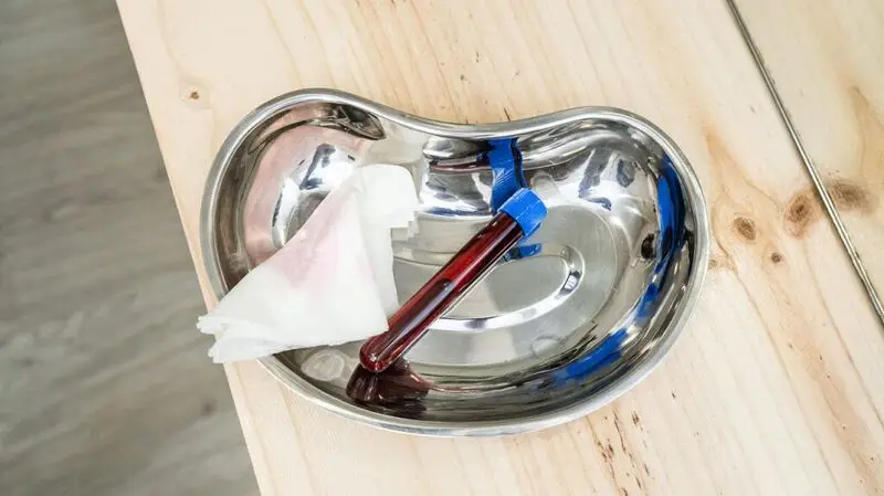 A blood test tube on a metal tray with gauze on the side