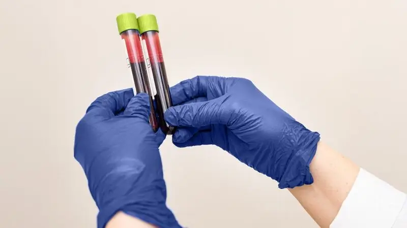 hands wearing surgical gloves holding two blood sample vials