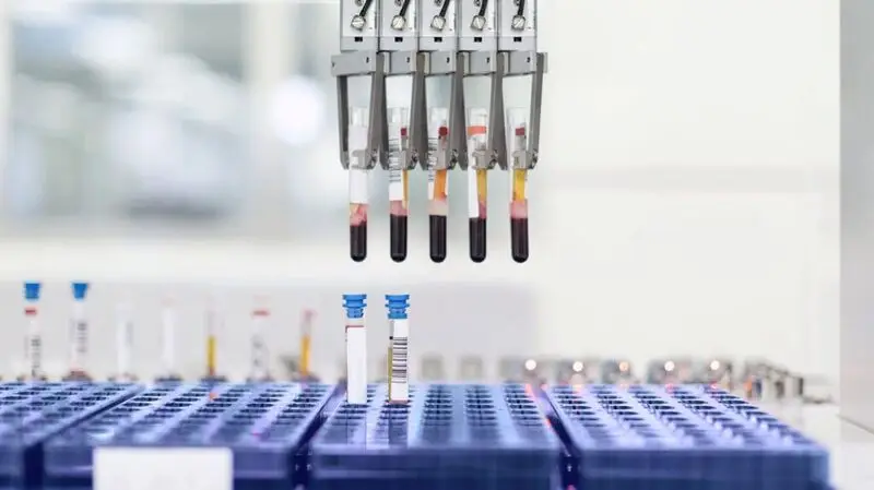 A machine holds five tubes of blood, lowering them into a test container to test for insulin resistance