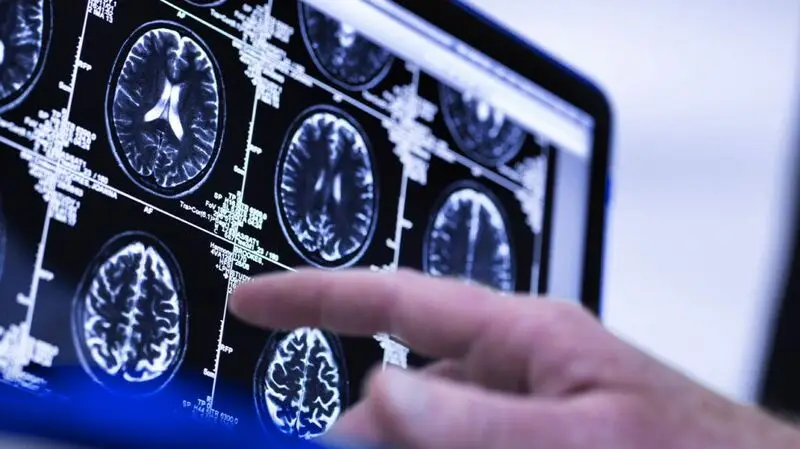 finger pointing at brain scans on screen