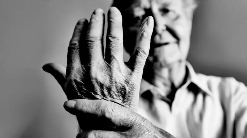 An older man holds his hands to the camera to show his deformed joints from rheumatoid arthritis