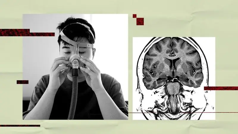 A collage of a person wearing a CPAP mask to treat sleep apnea and a brain scan