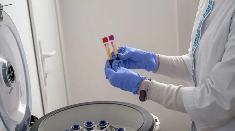 hands with medical gloves holding two vials with blood samples