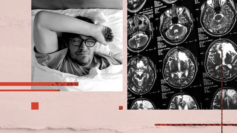 Collage of pictures including a male sleeping on his back and brain scan images