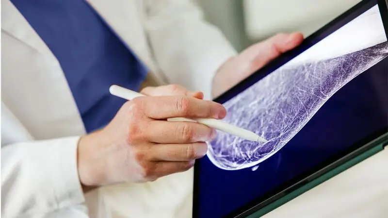 A doctor looking at a mammogram scan.