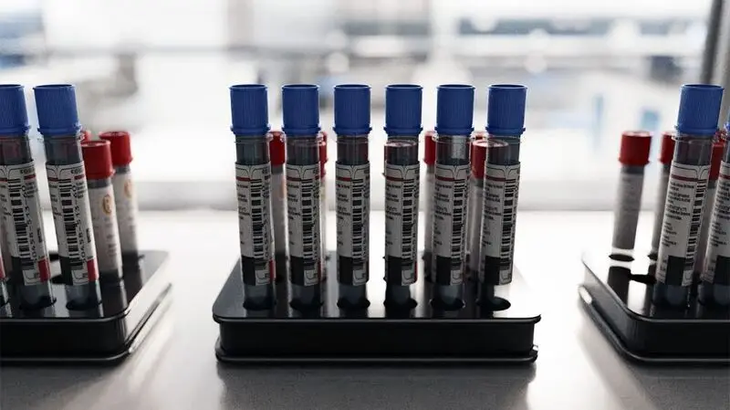 Blood samples in test tubes for medical diagnostics