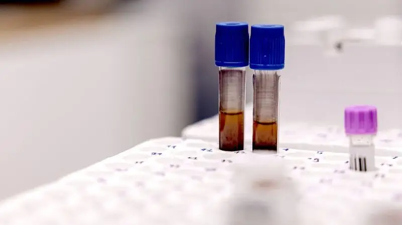 Two test tubes of blood in a tray in a lab to test for anemia and Alzheimer's blood biomarkers