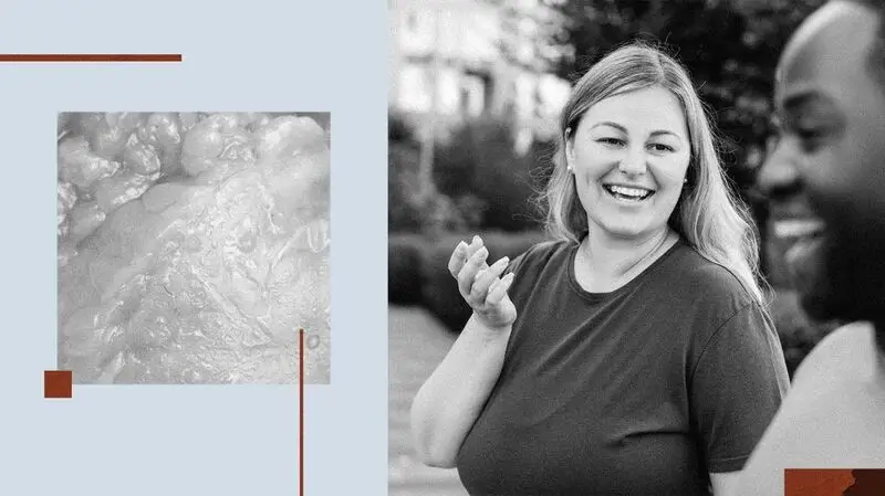 A collage showing fat cells and people walking outside.