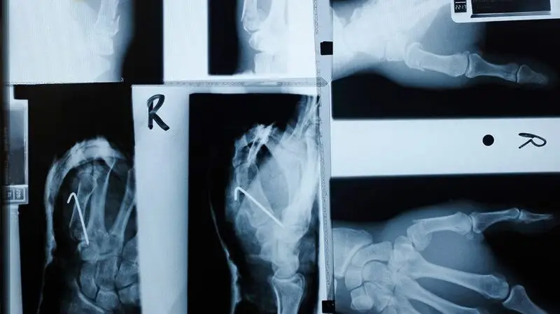 series of bone x rays