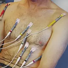 Dementia: Biomarker of heart damage may raise risk by 38%