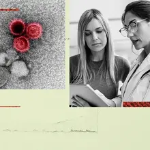 Could the Epstein-Barr virus be the culprit behind lupus?