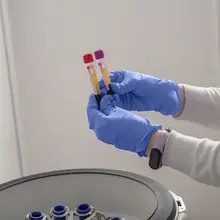 Alzheimer's: Obesity may be a key risk factor, study finds