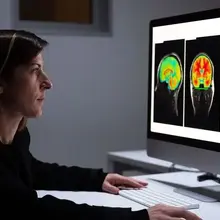 Alzheimer’s disease: AI tool may predict disease with high precision