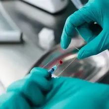 Colorectal cancer: New guidelines add 2 types of screening tools