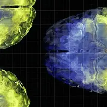 Aging brain health: Vitamin C levels linked to gray matter volume